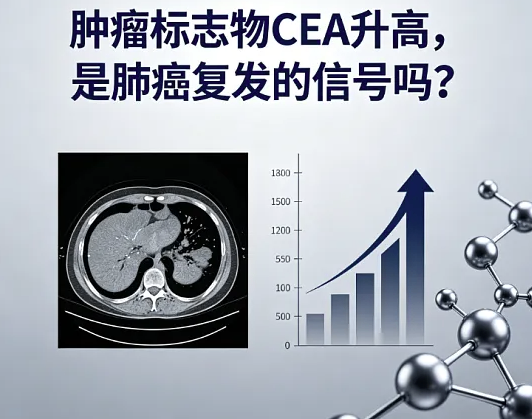 别慌！肺癌肿瘤标志物化验单，数字高≠确诊癌，一文教你分清该紧张还是放宽心